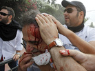 A wounded protester is led away from clashes with riot police in Athens earlier today (June 29, 2011). A wounded protester is led away from clashes with riot police in Athens earlier today (June 29, 2011).