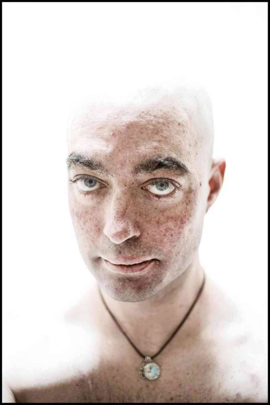 Ezra's self-portrait after his colostomy and second round of treatment. Ezra's self-portrait after his colostomy and second round of treatment.
