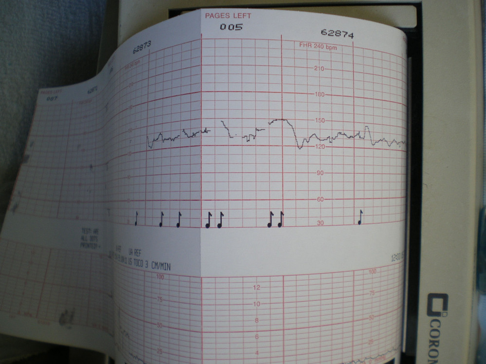 The squiggly lines show Lateefah's baby's heart rate and the  musical notes indicate where she pressed a clicker in response to feeling the baby move.