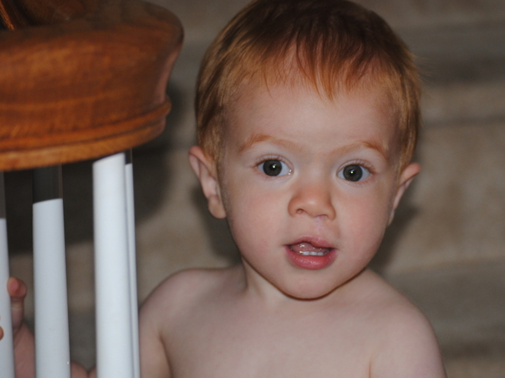 Christy's now-20-month-old son, James, was born with a cleft lip — a delivery surprise that Christy says seemed devastating at the time.