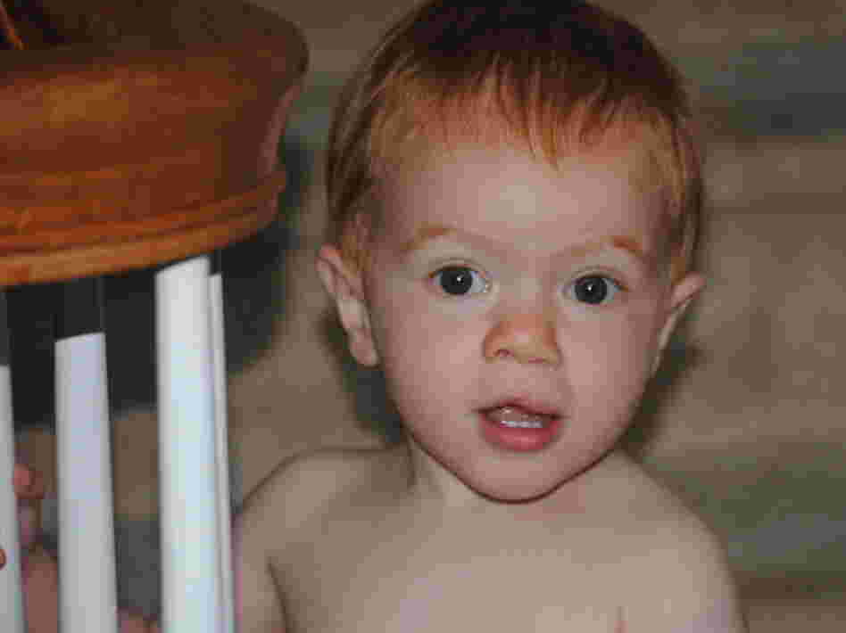 Christy's now-20-month-old son, James, was born with a cleft lip — a delivery surprise that Christy says seemed devastating at the time.