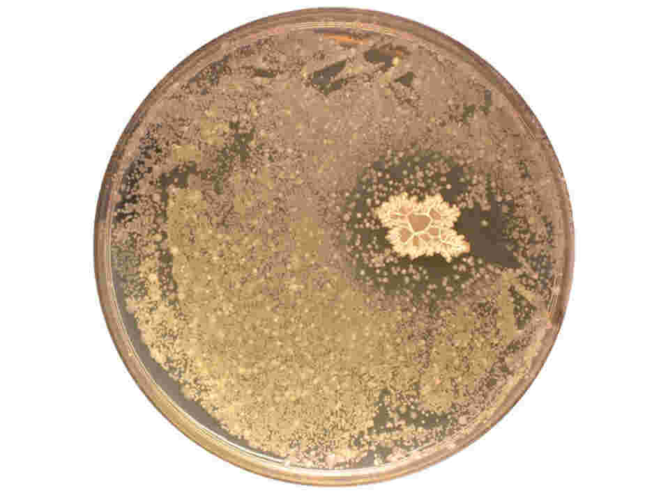 A petri dish shows a bacterial colony excreting antibiotics. A petri dish shows a bacterial colony excreting antibiotics.