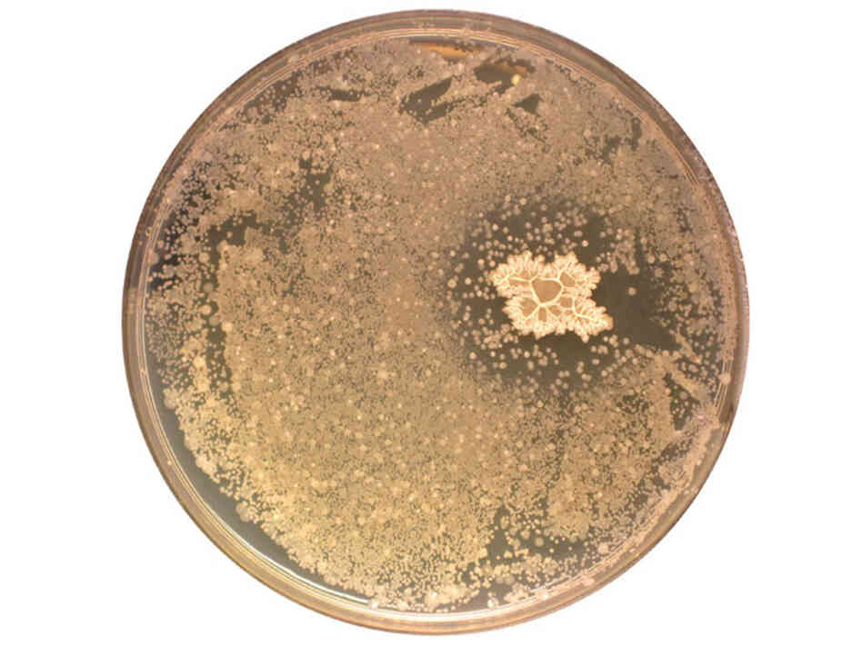A petri dish shows a bacterial colony excreting antibiotics. A petri dish shows a bacterial colony excreting antibiotics.