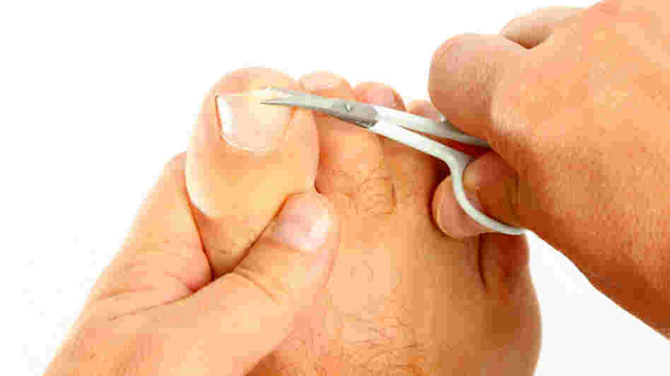 A man cutting his toenails.