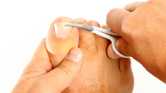 A man cutting his toenails.