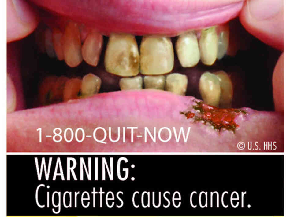 One of the nine new warning labels that will be featured on cigarette packs next year. One of the nine new warning labels that will be featured on cigarette packs next year.