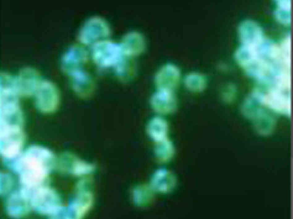 Antibiotic-resistant gonorrhea light up this microscopic view.