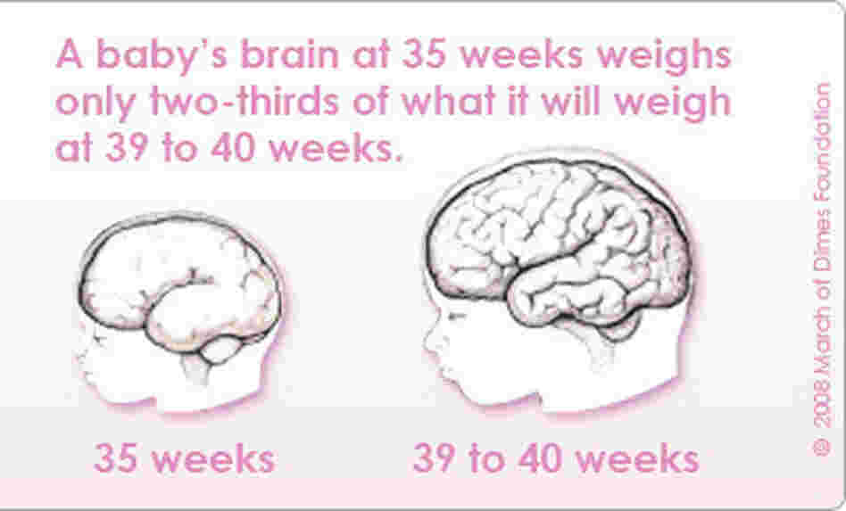 A baby's brain still has a lot of growing to do between 35 and 39 weeks in the womb. A baby's brain still has a lot of growing to do between 35 and 39 weeks in the womb.