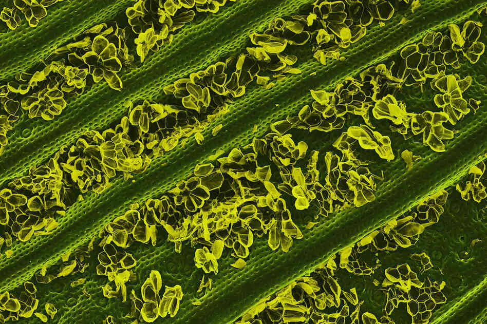 HINT: Pina fiber is made from this; hopefully it won't make it into your pina colada.PREVIOUS SLIDE: Cake sprinkles, 65 times magnification 