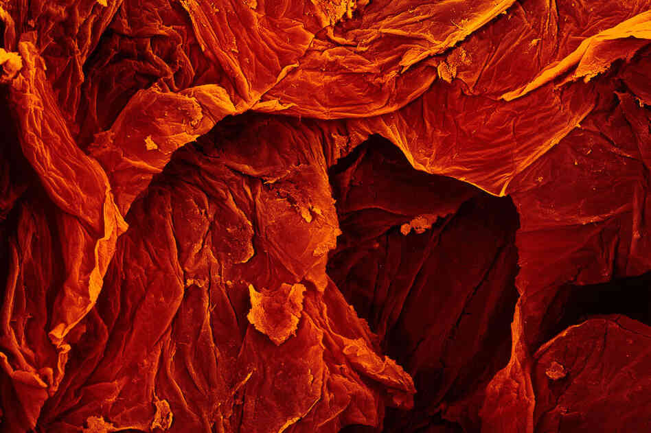 HINT:They should wear SPF when they bathe in the Italian sun.PREVIOUS SLIDE: Radish, 60 times magnification 