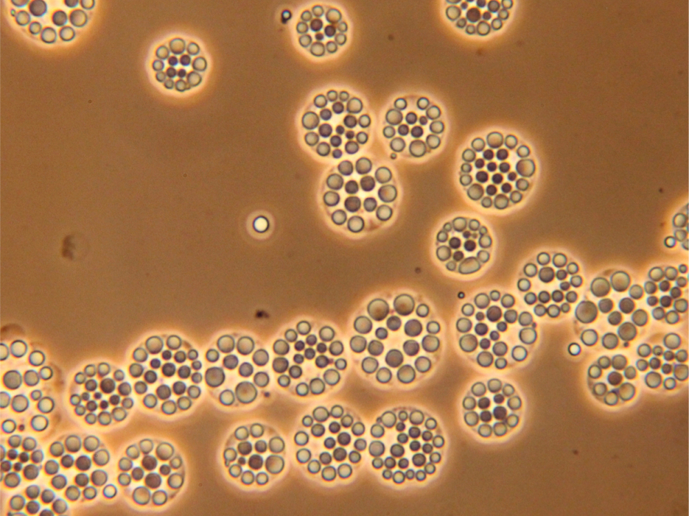 Chlamydomonas cells filled with spherical lipid bodies