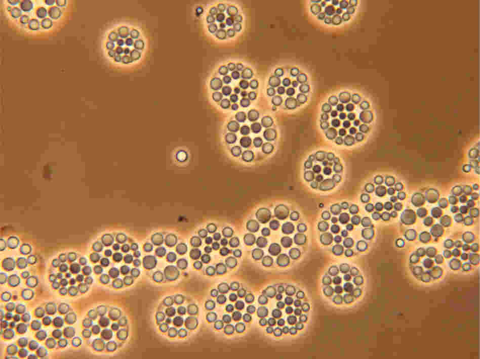 Chlamydomonas cells filled with spherical lipid bodies