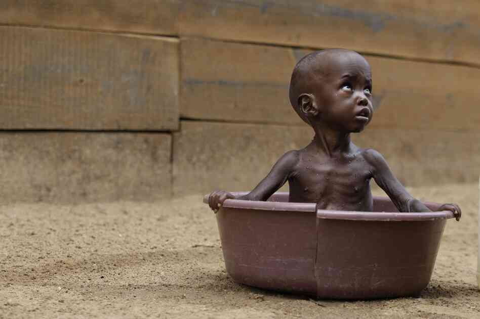 Aden Salaad, 2, is bathed by his mother in a tub at a Doctors Without Borders hospital, where Aden is receiving treatment for malnutrition, in Dagahaley camp, outside Dadaab, Kenya on July 11. 
