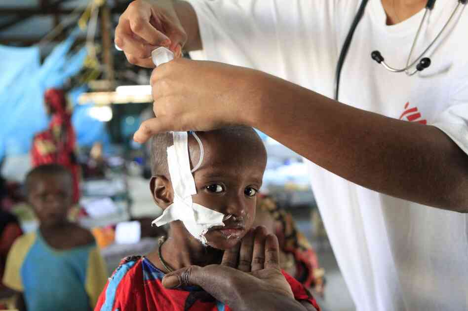 Suldano Osman, 1, is steadied by her mother's hand as a pediatrician attaches a feeding tube to aid her treatment for malnutrition at a Doctors Without Borders hospital in the Dagahaley camp on July 11. 