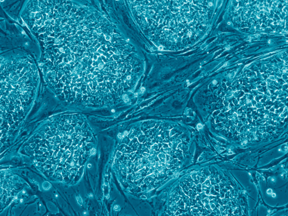 Human embryonic stem cells like these have stirred quite a legal controversy. Human embryonic stem cells like these have stirred quite a legal controversy.