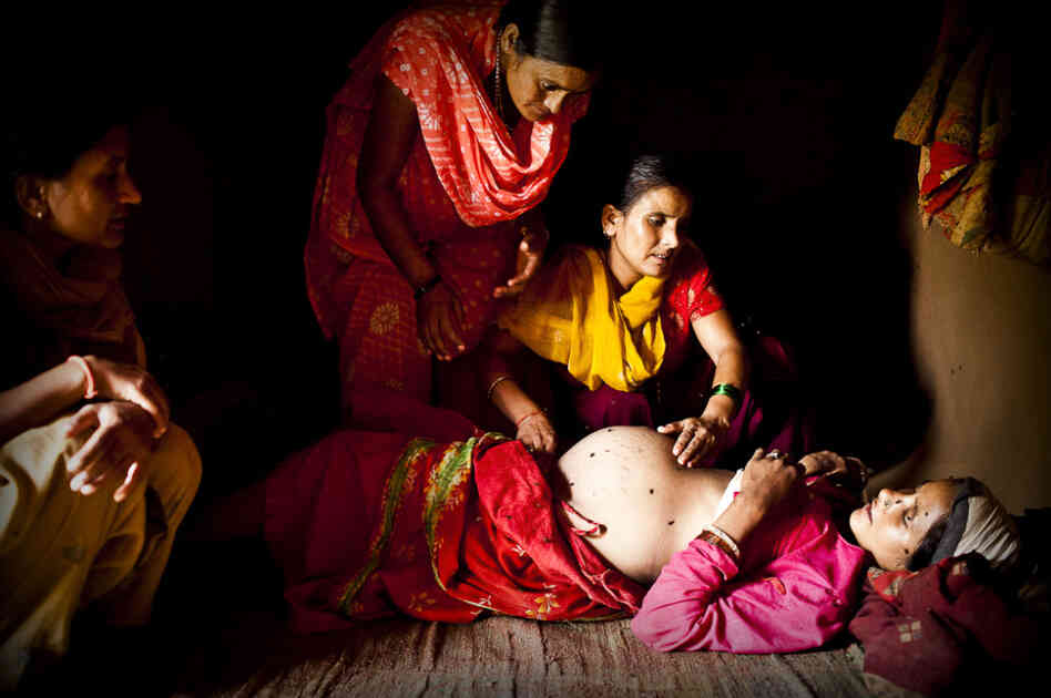 An aid worker examines Maheshwori and determines that her unborn baby is in a breech position. Because of the dangers associated with such a delivery, the aid worker makes a case to the village elders that a skilled birth attendant should be brought in to assist with the birth, rather than relying on an untrained traditional birth attendant.