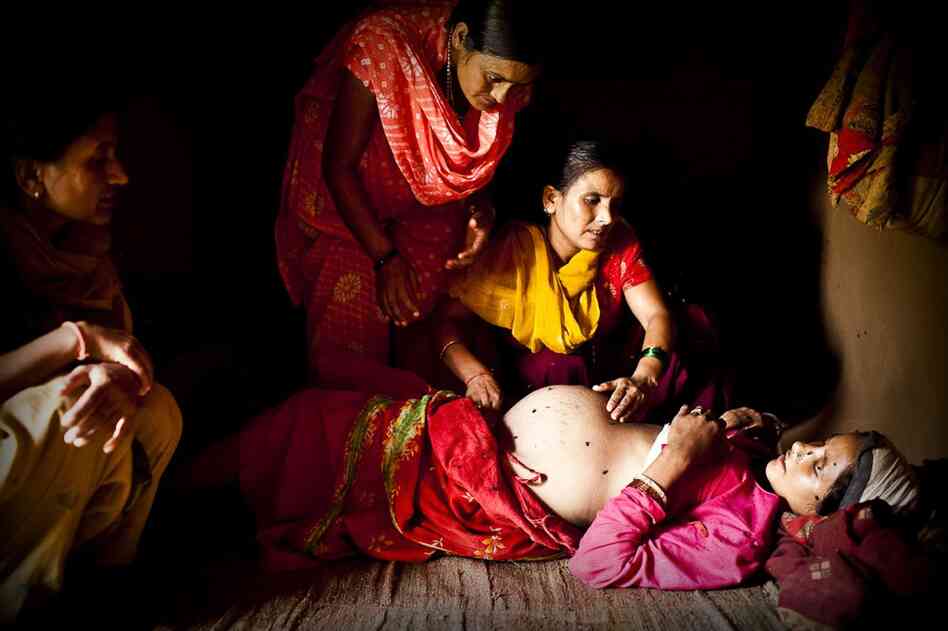 An aid worker examines Maheshwori and determines that her unborn baby is also in a breech position. Because of the dangers associated with such a delivery, the aid worker makes a case to the village elders that a skilled birth attendant should be brought in to assist with the birth, rather than relying on an untrained traditional birth attendant.