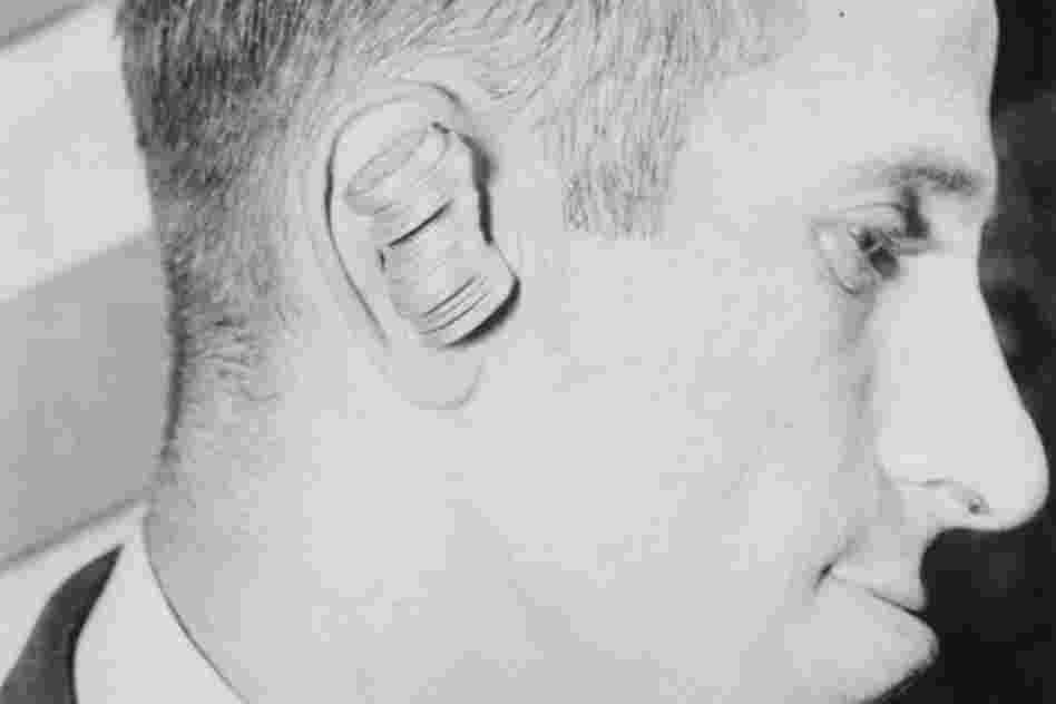Max Calvin of Brooklyn could hold 25 quarters in his ear, 1933.