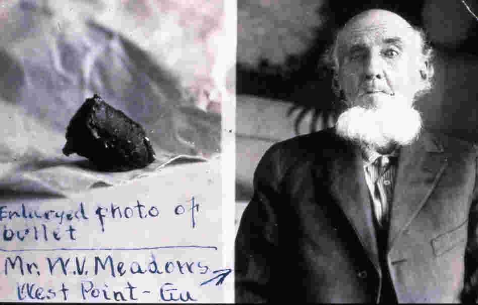 W. V. Meadows of West Point, Ga., was shot in the eye at the battle of Vicksburg and unexpectedly coughed up the Civil War bullet 58 years later.