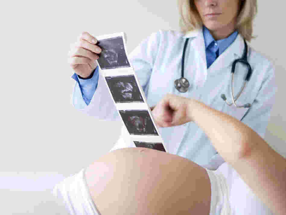 A new fetal DNA test to determine a baby's gender could be more accurate and faster than an ultrasound, researchers say.