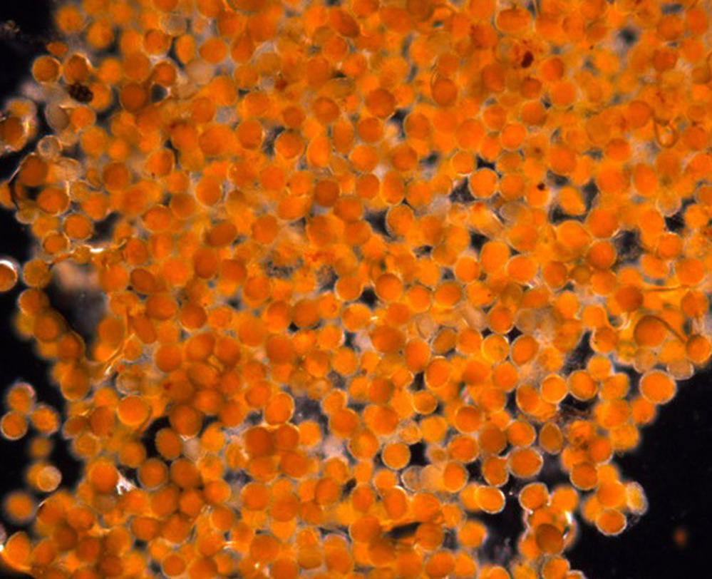 Scientists say the microscopic eggs, seen here under magnification, derive their orange color from a droplet of fat.