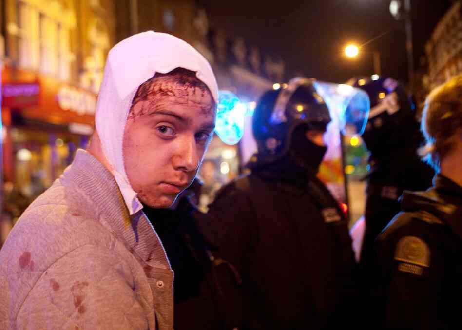 Police arrest an injured man for looting in South London on Aug. 8. 