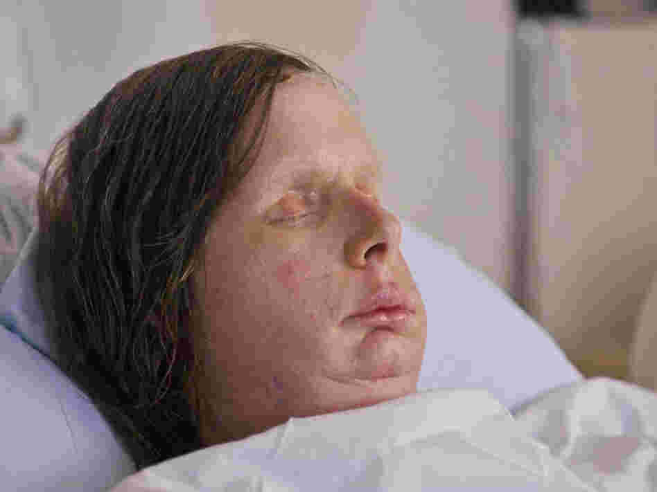 Charla Nash received a full face transplant after she was mauled by a chimpanzee in 2009. The procedure was performed last month by a team of plastic and orthopedic surgeons at Brigham and Women's Hospital in Boston.