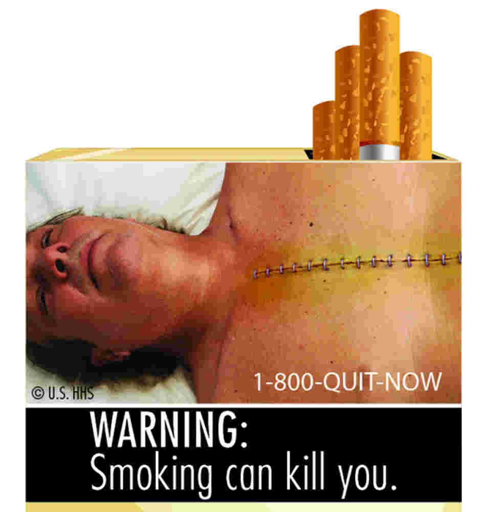 Another of the startling images that will soon be appearing on cigarette packages. Another of the startling images that will soon be appearing on cigarette packages.