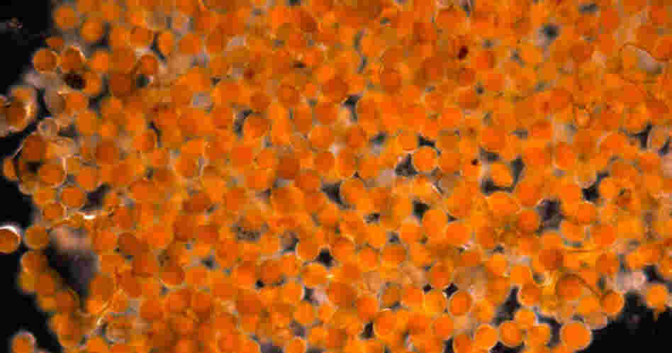 This sample of orange goo has been identified as a mass of rust fungus spores.