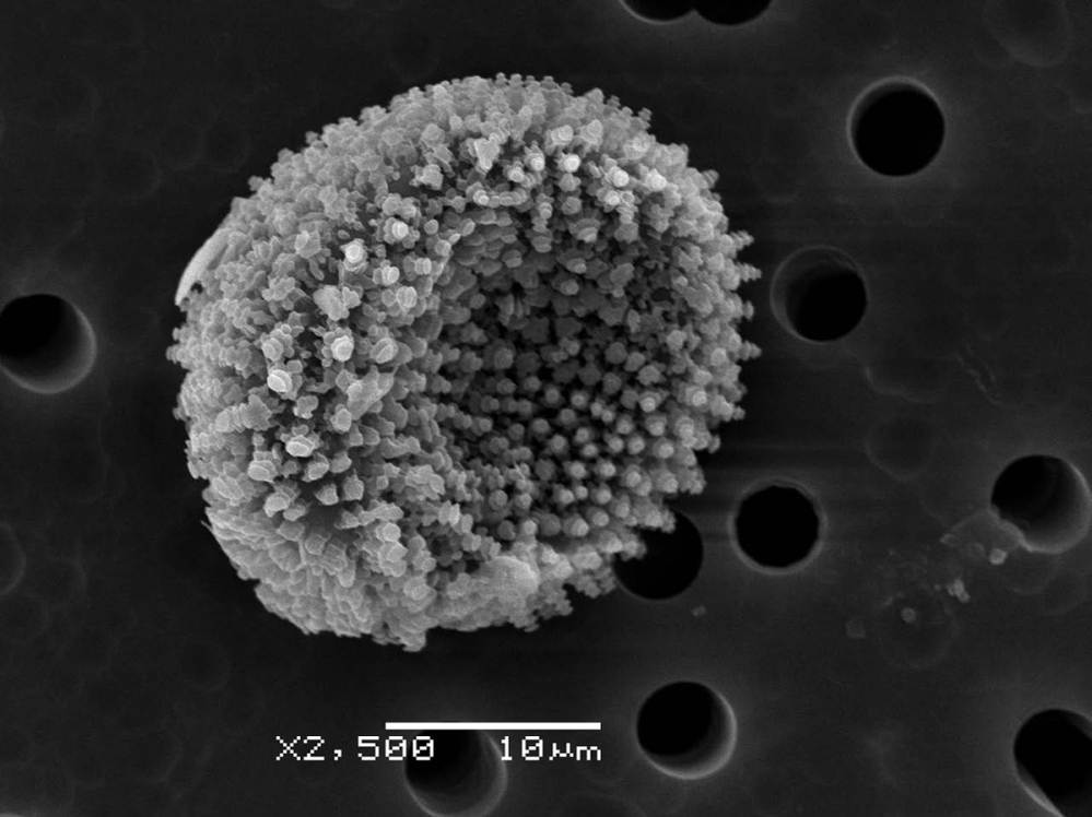 A single "uredo"-spore from the Alaskan sample, as seen in a closeup via scanning electron microscope.