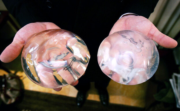A silicone gel implant (left) and a saline gel implant. The FDA agreed to let implants return to the market in 2006, but stipulated that manufacturers track long-term side effects. A silicone gel implant (left) and a saline gel implant. The FDA agreed to let implants return to the market in 2006, but stipulated that manufacturers track long-term side effects.