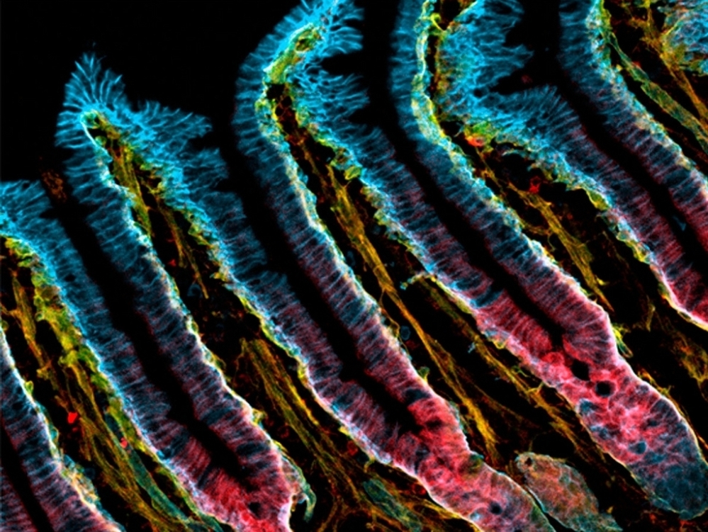 Microvilli, the finger-like projections from the small intestine, provide a home for huge numbers of microbes.