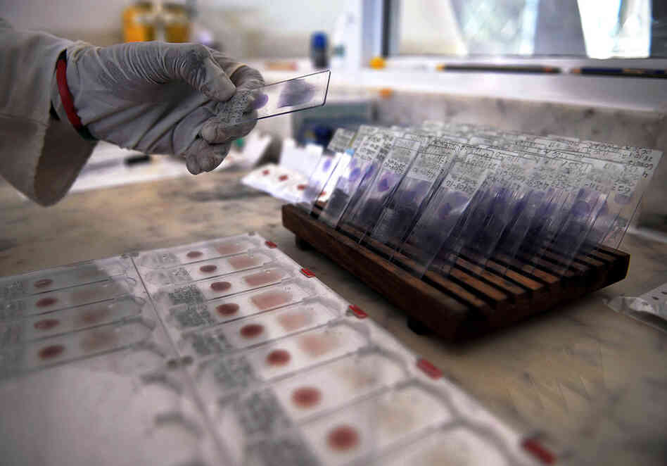 A lab technician prepares blood samples from volunteers for viral-genotyping at a government-run health center in Bagamoyo, Tanzania in 2009. Tanzania is currently hosting the final stages of a human trial of a pioneering vaccine against malaria. The vaccine is one of many medical innovations to emerge from Walter Reed over the decades. 