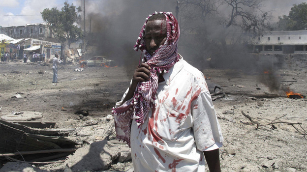 A wounded man stands at the scene of the explosion in Mogadishu, Somalia, earlier today. 