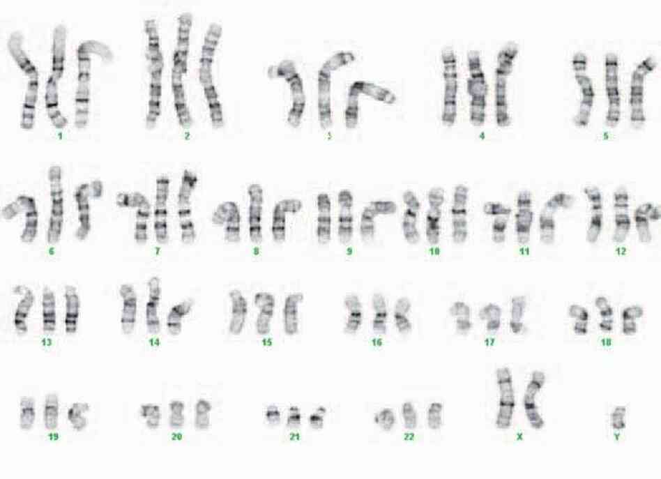 This image shows the chromosomes from one of the cloned cells. Notice there are three sets of each chromosome; normal cells have just two copies of each chromosome. This image shows the chromosomes from one of the cloned cells. Notice there are three sets of each chromosome; normal cells have just two copies of each chromosome.