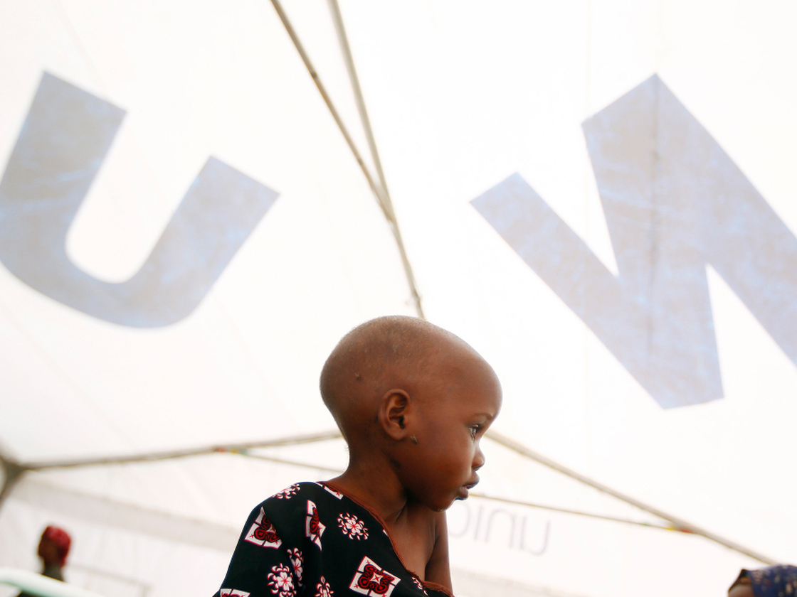 Madow Weydow, 3, from Somalia, sits in an eastern Kenyan hospital near the Somali border. Madow is suffering from anorexia and severe malnutrition. 