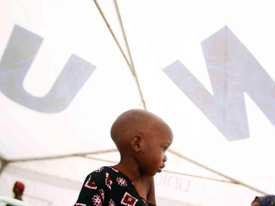 Madow Weydow, 3, from Somalia, sits in an eastern Kenyan hospital near the Somali border. Madow is suffering from anorexia and severe malnutrition. 