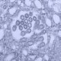 H1N1 virus virons appear in a tissue sample.