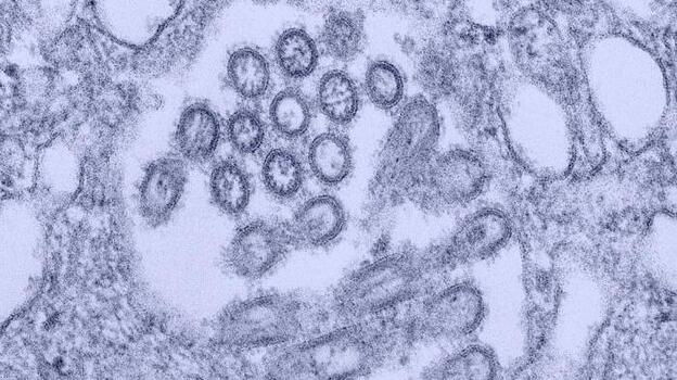 H1N1 virus virons appear in a tissue sample. (CDC Public Health Image Library)