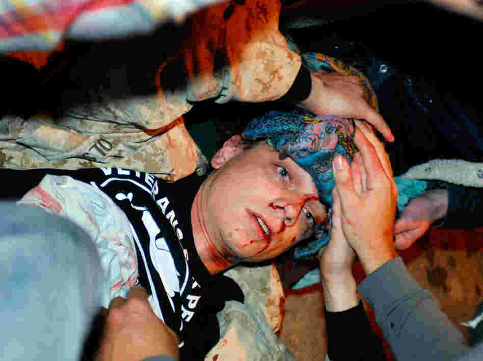 Olsen lies on the ground bleeding from a head wound after being hit by a projectile during the Occupy Oakland protest on Tuesday. 