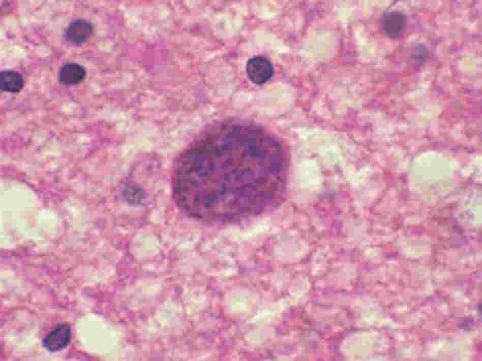 Toxoplasma gondii is a parasite, seen here in brain tissue, that can alter the behavior of the host. It can make rodents attracted to cats, leaving them vulnerable to getting eaten. Toxoplasma gondii is a parasite, seen here in brain tissue, that can alter the behavior of the host. It can make rodents attracted to cats, leaving them vulnerable to getting eaten.