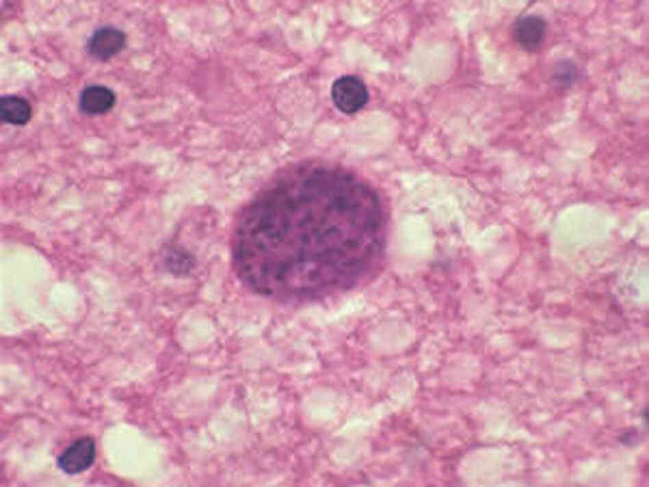 Toxoplasma gondii is a parasite, seen here in brain tissue, that can alter the behavior of the host. It can make rodents attracted to cats, leaving them vulnerable to getting eaten. Toxoplasma gondii is a parasite, seen here in brain tissue, that can alter the behavior of the host. It can make rodents attracted to cats, leaving them vulnerable to getting eaten.
