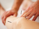 Quite a few hospitals are getting in on the acupuncture act. Quite a few hospitals are getting in on the acupuncture act.
