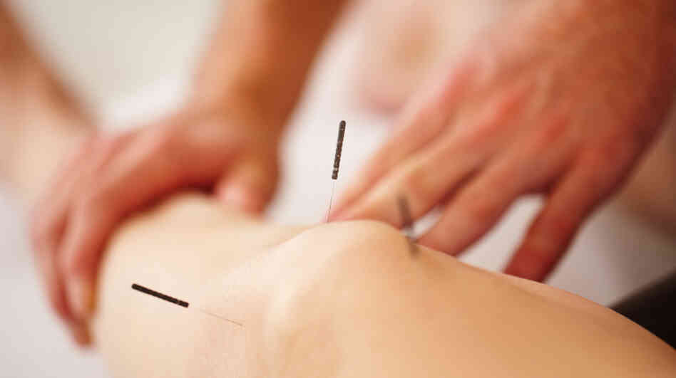 Quite a few hospitals are getting in on the acupuncture act.