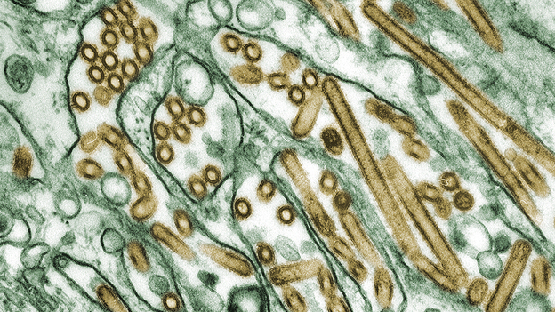 H5N1 avian flu viruses (seen in gold) grow inside canine kidney cells (seen in green). (CDC)