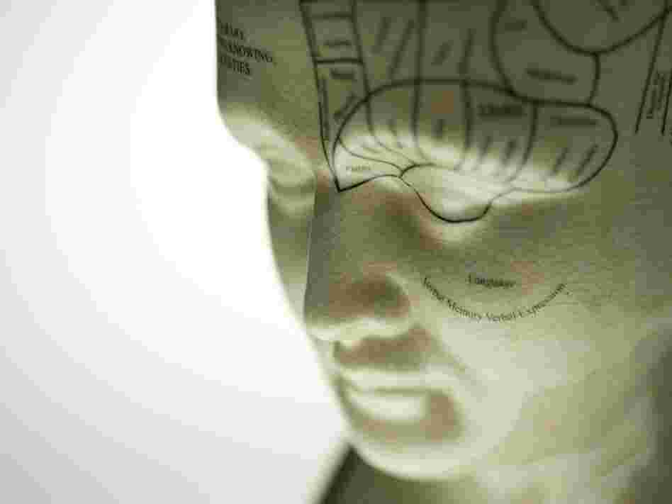 Brain diagram