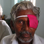 Patients sit after their cataract surgeries at a hospital of the Aravind Eye Care System in Madurai, India. Patients sit after their cataract surgeries at a hospital of the Aravind Eye Care System in Madurai, India.