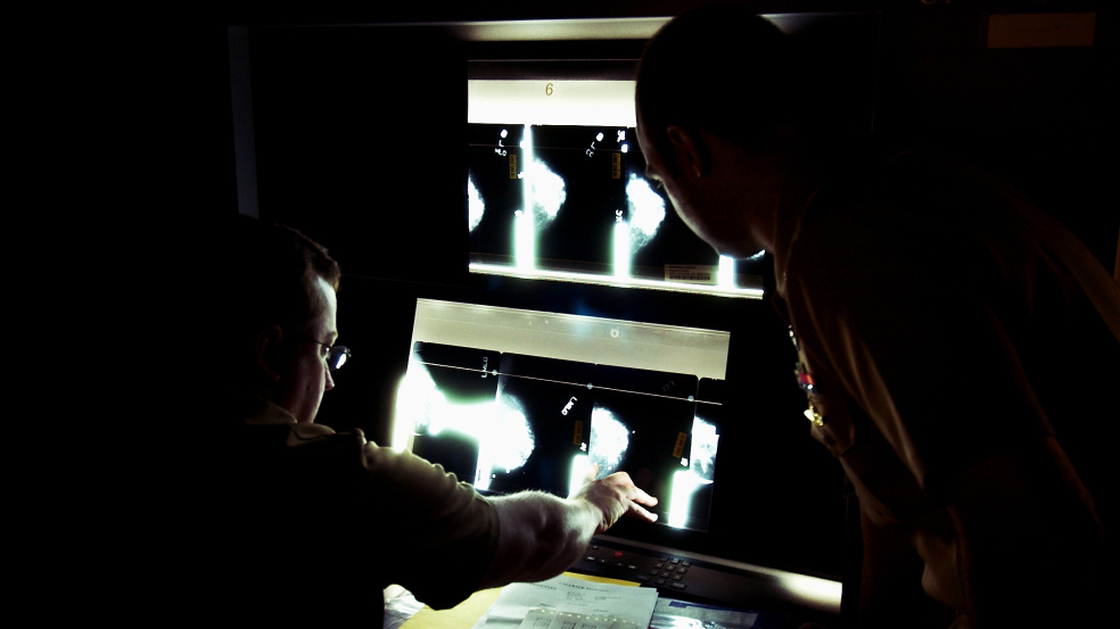 U.S. Navy doctors Lt. Cmdr Ralph Pickard (left) and Ens. Jesse Rohloff study a patient's mammogram images at the National Naval Medical Center in Bethesda, Md. 