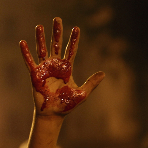 An Egyptian protester shows his palm stained with blood from a wounded demonstrator during clashes with security forces in Cairo on Friday.