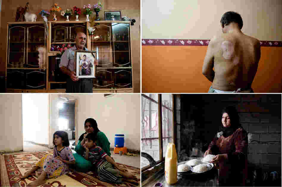 Iraqi photographer Pazhar Mohammad tells the story of Kirkuk, an oil-rich city in northern Iraq with a grisly past and an uncertain future. His portraits show Iraqis who have been injured or who have lost loved ones. Iraqi photographer Pazhar Mohammad tells the story of Kirkuk, an oil-rich city in northern Iraq with a grisly past and an uncertain future. His portraits show Iraqis who have been injured or who have lost loved ones.